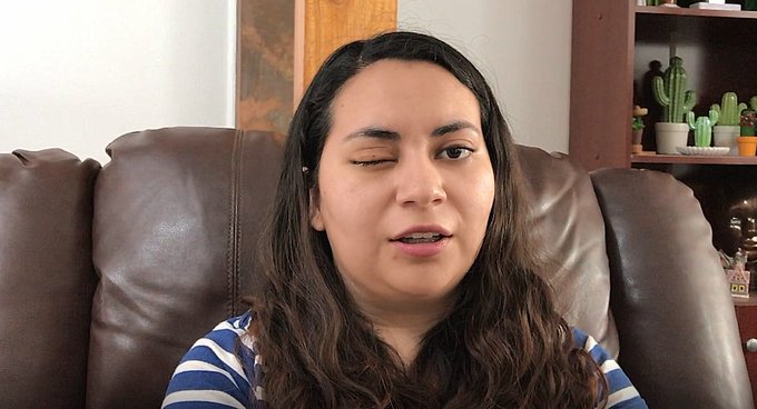 Natalia Aravena sufrió la amputación de su ojo derecho. Hoy usa una prótesis ocular.